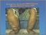 [thumbnail of Filariasis di Indonesia.jpg]