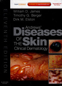 Image of Andrew's disease of the skin clinical dermatology