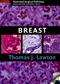 Image of Breast: Illustrated Surgical Pathology