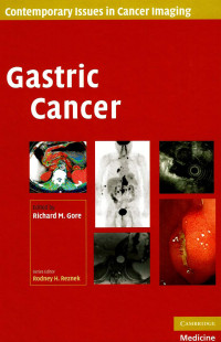 Image of Geneitc Cancer