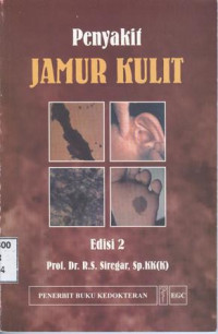 Image of Penyakit Jamur Kulit