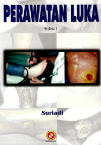 Image of Perawatan Luka