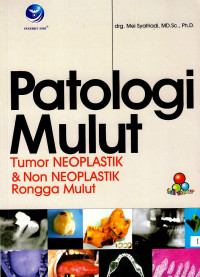 Image of Patologi mulut: tumor neoplastik & dan non neoplastik  rongga mulut