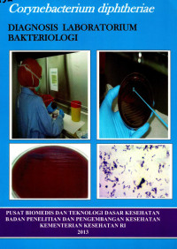 Image of Corynebacterium Diphtheriae : Diagnosis Laboratorium Bakteriologi