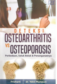 Image of Deteksi Osteoarthritis VS Osteoporosis  : Perbedaan, Seluk Beluk & Penanganan nya